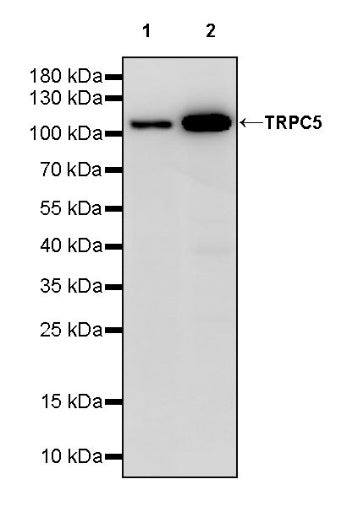 TRPC5 Recombinant Rabbit mAb (S-1901-38)