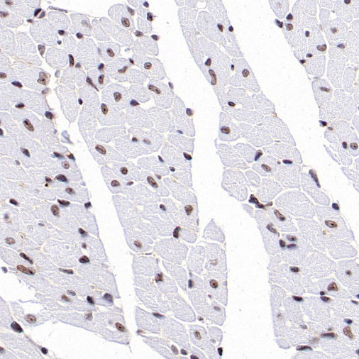 SIRT1 Recombinant Rabbit mAb (S-1886-15)