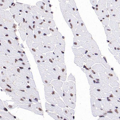 SIRT1 Recombinant Rabbit mAb (S-1886-15)