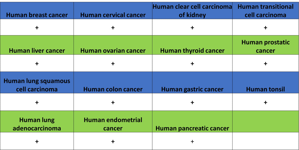 Galactosylceramidase Recombinant Rabbit mAb (S-3402-17)