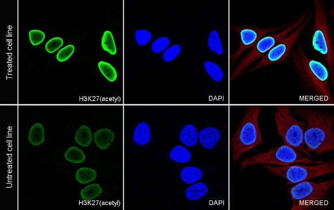 Histone H3 (acetyl K27) Recombinant Rabbit mAb (S-699-50)