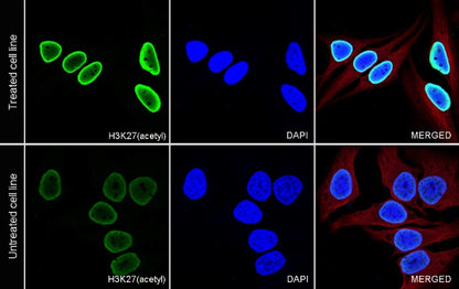 Histone H3 (acetyl K27) Recombinant Rabbit mAb (S-699-50)