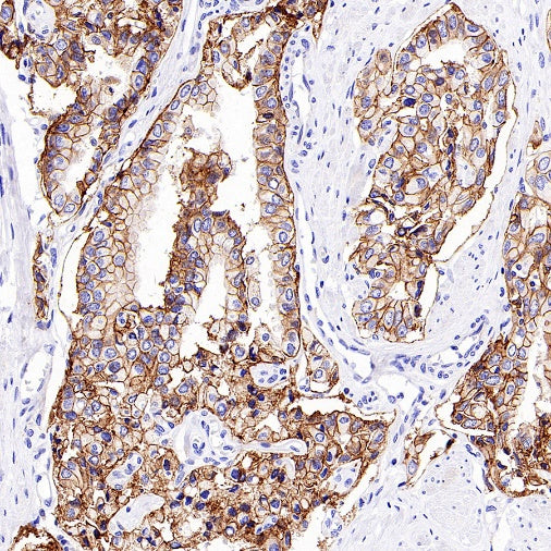 Mrp4 Recombinant Rabbit mAb (S-2305-17)