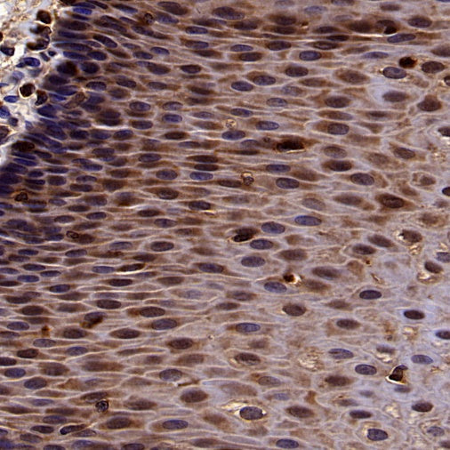 p38 delta/MAPK13 + p38 alpha/MAPK14 Recombinant Mouse mAb (S-3860)