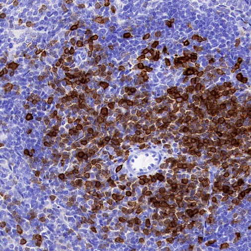 CD5 Recombinant Rabbit mAb (SDT-2570-53)