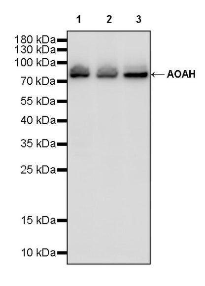 AOAH Recombinant Rabbit mAb (S-3713-10)