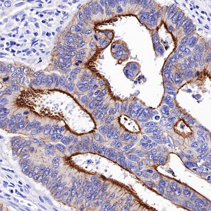Villin Recombinant Rabbit mAb (SDT-R255)