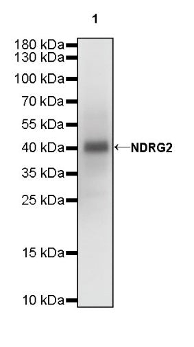 NDRG2 Recombinant Rabbit mAb (S-618-76)