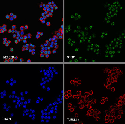 SF3B1 Rabbit Polyclonal Antibody