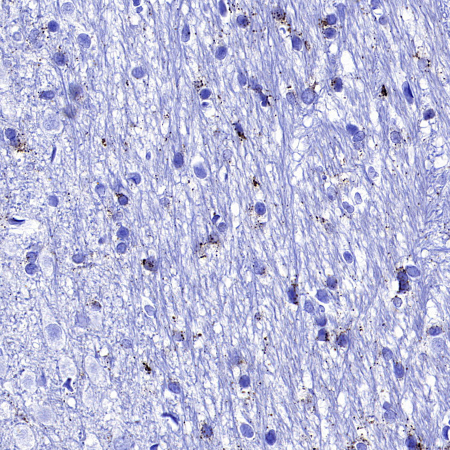 Galactosylceramidase Recombinant Rabbit mAb (S-3402-17)