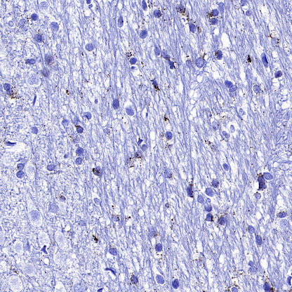 Galactosylceramidase Recombinant Rabbit mAb (S-3402-17)