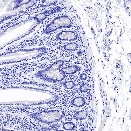 ALPP/ALPPL2 Recombinant Rabbit mAb, PBS Only (SDT-2088-32)