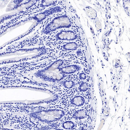 ALPP/ALPPL2 Recombinant Rabbit mAb, PBS Only (SDT-2088-32)