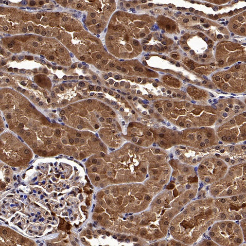 Superoxide dismutase Rabbit Polyclonal Antibody