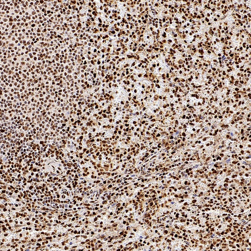 SAMHD1 Recombinant Rabbit mAb (S-2401-25)