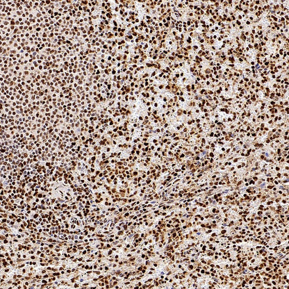 SAMHD1 Recombinant Rabbit mAb (S-2401-25)