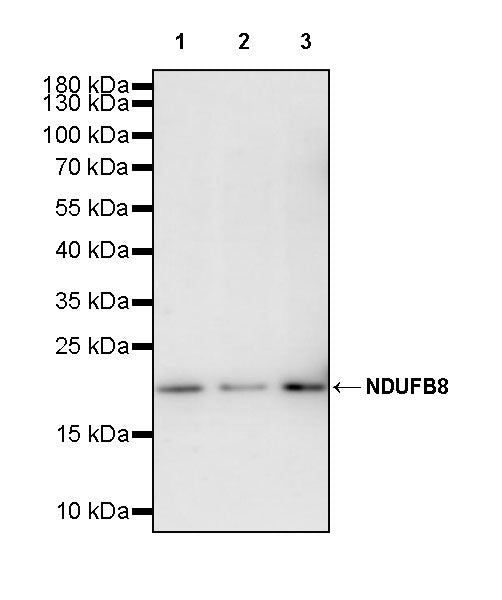 NDUFB8 Recombinant Mouse mAb (S-M0007)