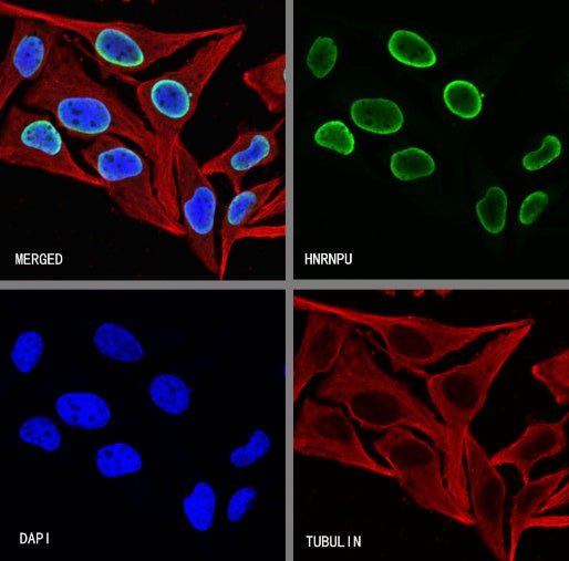 hnRNP U Recombinant Rabbit mAb (S-2375-23)