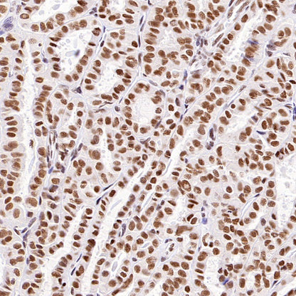 HDAC3 Recombinant Rabbit mAb (S-1977-31)