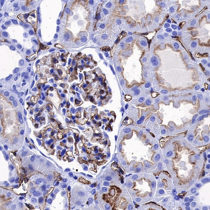 CD66a/CEACAM1 Recombinant Rabbit mAb (S-678-53)