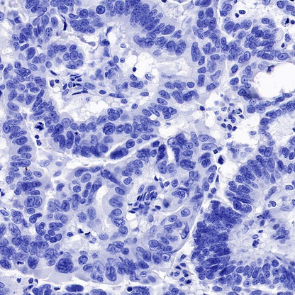 Cardiac Troponin I Recombinant Rabbit mAb (S-1352-15)