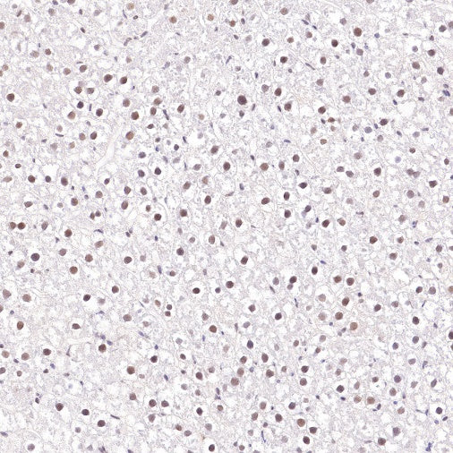 RUVBL1 Recombinant Rabbit mAb (S-1600-38)