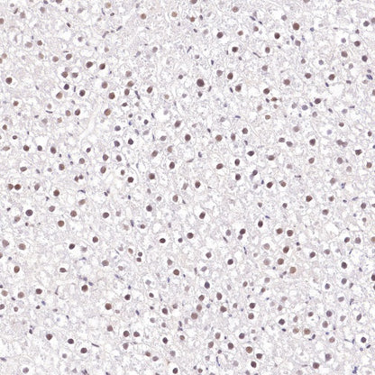 RUVBL1 Recombinant Rabbit mAb (S-1600-38)