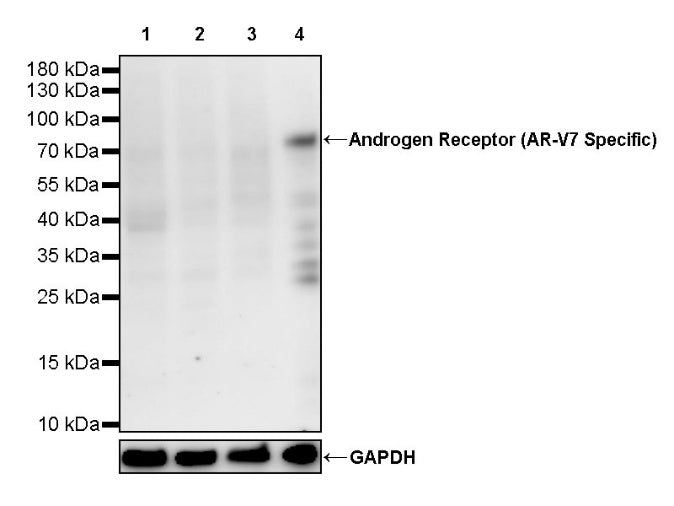 Androgen Receptor (AR-V7 Specific) Recombinant Rabbit mAb (S-2694-53)