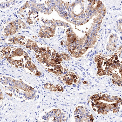 PAP Recombinant Rabbit mAb (SDT-702-140)