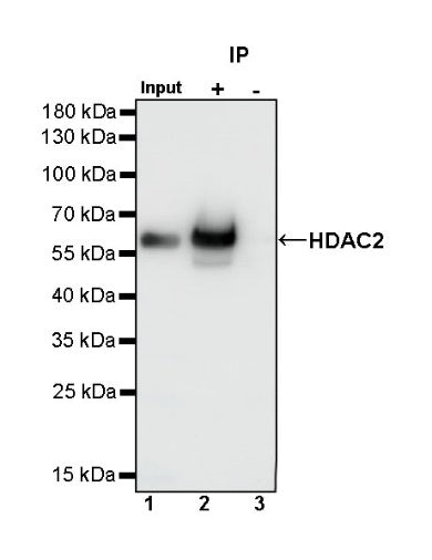 HDAC2 Recombinant Rabbit mAb (S-1474-27)