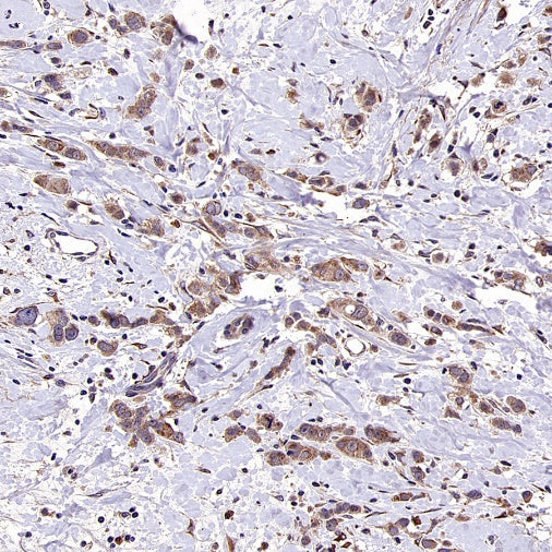 IGF2BP2 Rabbit Polyclonal Antibody
