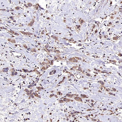 IGF2BP2 Rabbit Polyclonal Antibody
