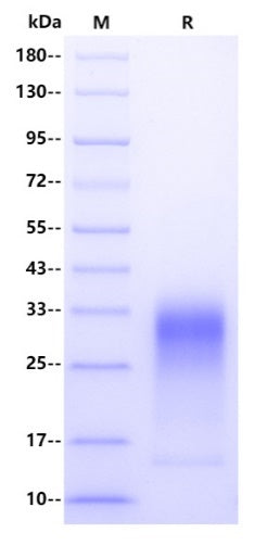 Mouse IL-13 Protein, His tag