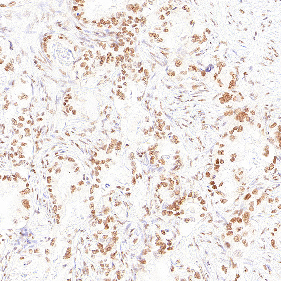 RAD21 Recombinant Rabbit mAb (S-4271-136)