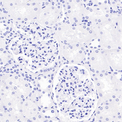 Reg4 Recombinant Rabbit mAb (SDT-1232-23)