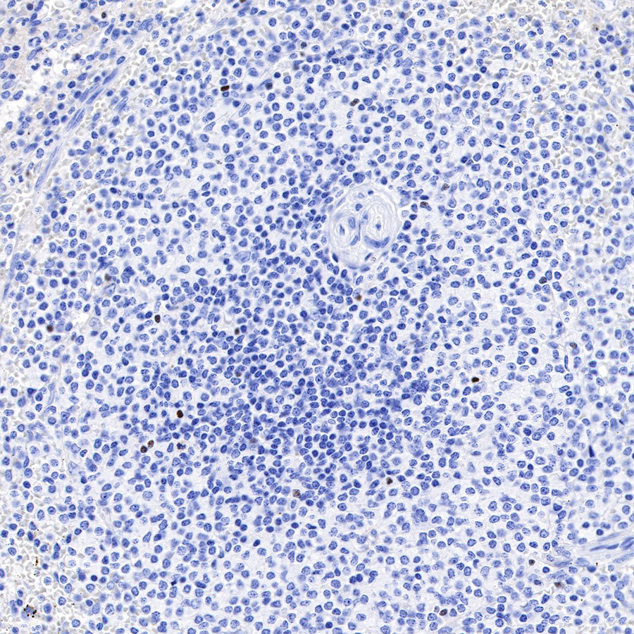 FOXP3 Recombinant Rabbit mAb (SDT-R064)