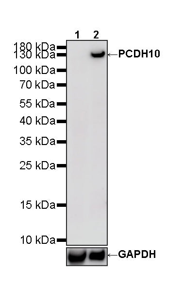 PCDH10 Recombinant Rabbit mAb (S-4531-4)