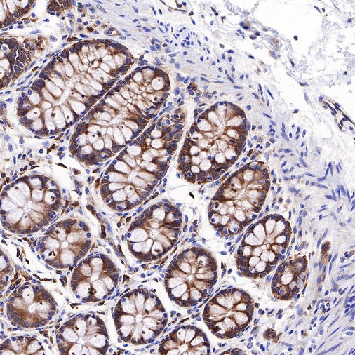 RPL26L1 Recombinant Rabbit mAb (S-R317)