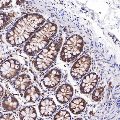 RPL26L1 Recombinant Rabbit mAb (S-R317)