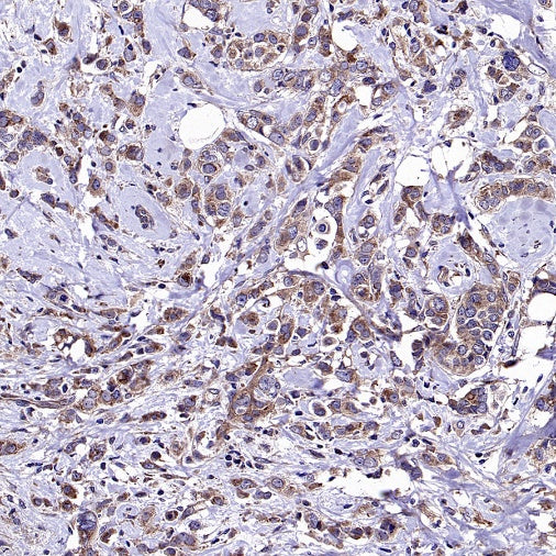 APC6 Recombinant Rabbit mAb (S-2550-48)