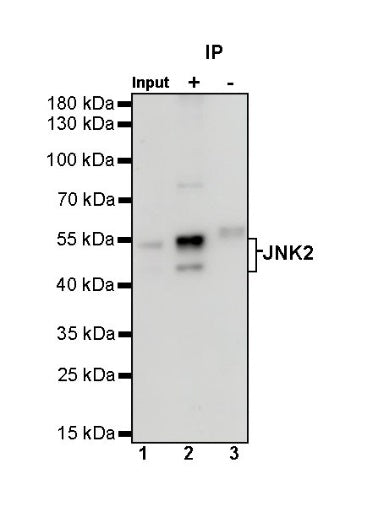 JNK2 Recombinant Rabbit mAb (S-1021-46)