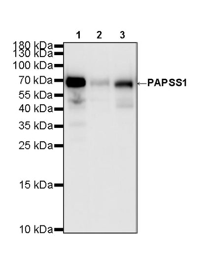PAPSS1 Recombinant Rabbit mAb (S-3516-23)