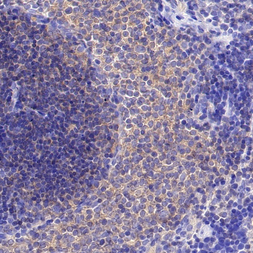PLCγ2 Recombinant Rabbit mAb (S-2749-14)