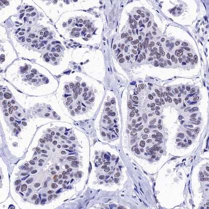U2AF2 Recombinant Rabbit mAb (S-1324-1)