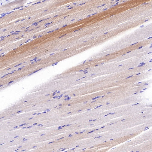 Alpha B Crystallin Recombinant Rabbit mAb (S-R216)