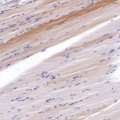 Alpha B Crystallin Recombinant Rabbit mAb (S-R216)