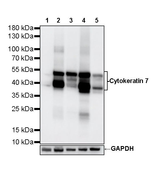 Cytokeratin 7 Recombinant Rabbit mAb (S-5954)