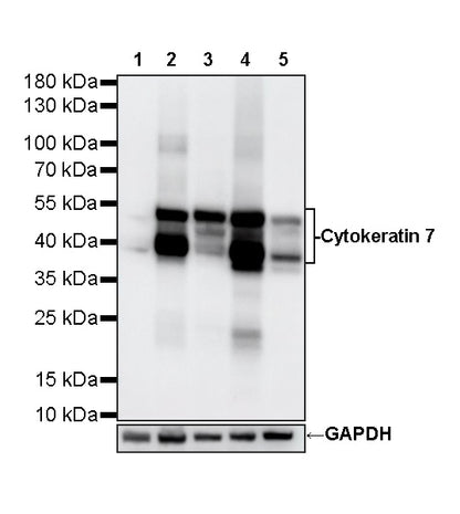 Cytokeratin 7 Recombinant Rabbit mAb (S-5954)