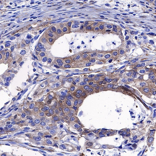 PKC alpha Recombinant Rabbit mAb (S-624-36)