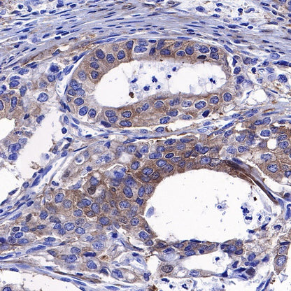 PKC alpha Recombinant Rabbit mAb (S-624-36)